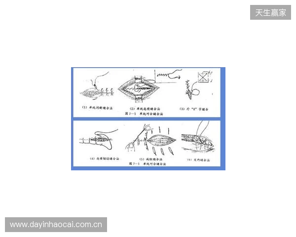 广州豹官方：杨浩眉弓伤口缝合30余针，预计5-7天后拆线